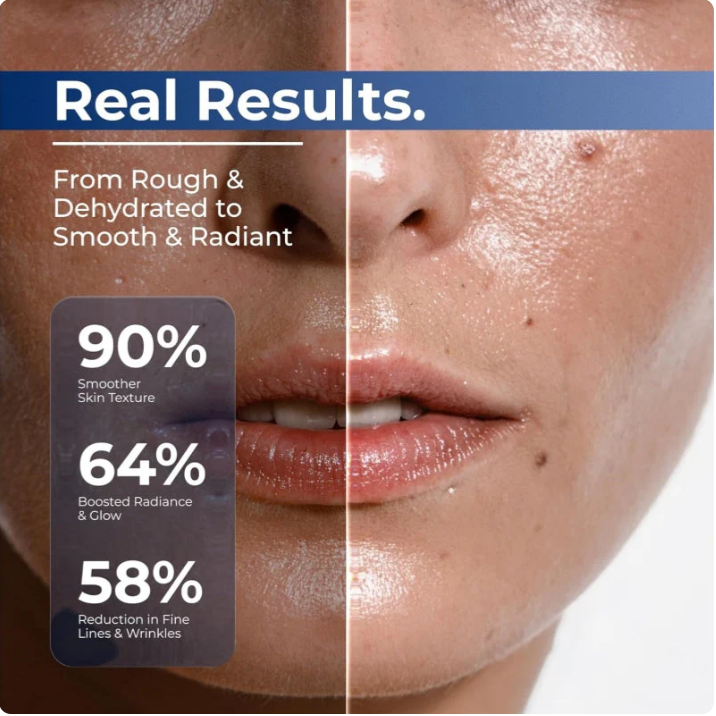 3% Hyaluronic Acid Serum