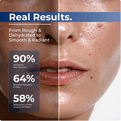 3% Hyaluronic Acid Serum