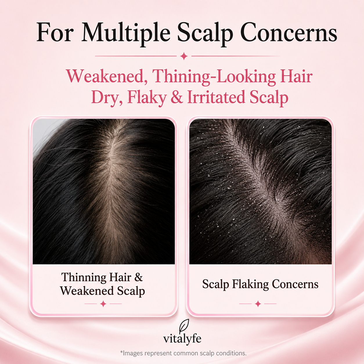 Rosemary PDRN Nourishing Scalp Serum - For Thinning Hair & Flakey Scalp